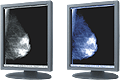 Clear base/Blue base LCD panels