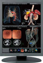 CCL358i2 | 医用画像表示用ディスプレイソリューション | 製品情報